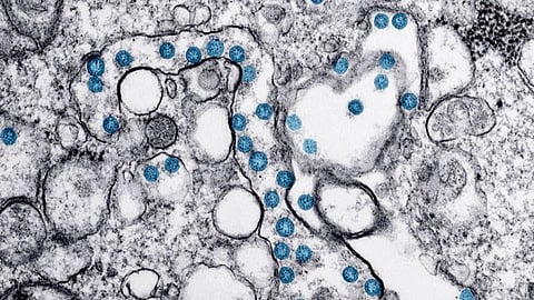 El paciente infectado de coronavirus se encuentra aislado (Foto: ONU)