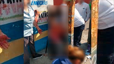 Fue trasladado aun hospital para ser atenido (Foto: RED113)