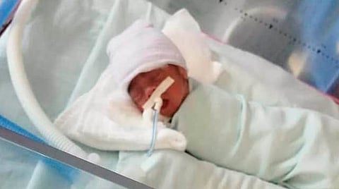 El pequeño Ángel David fue hospitalizado durante tres meses en el IMSS, ya que nació de seis meses (Foto: Cortesía)