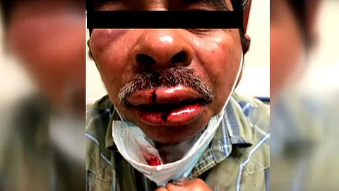 La policía investiga el suceso (Foto: captura de pantalla)