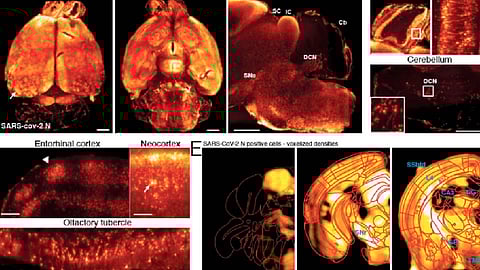 Según el estudio, el virus puede duplicarse dentro del cerebro y su presencia priva de oxígeno a las células cerebrales cercanas (Foto Twitter: @twhitfill)