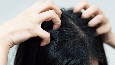 Las picaduras de los piojos reducían en gran medida los niveles de hierro en la sangre de la pequeña (Foto: hospitalrosario.es)
