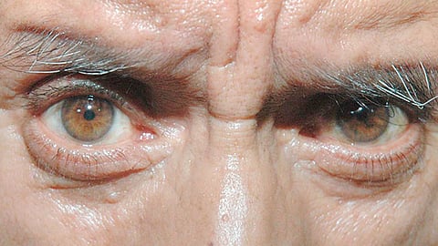 En Michoacán se estima que son cerca de 500 mil ciudadanos los que van a padecer esta enfermedad crónica degenerativa (Foto: gob.mx)