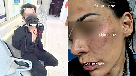 La pareja de Eleazar Gómez mostró las heridas que el actor le causó (Foto Twitter: @c4jimenez)