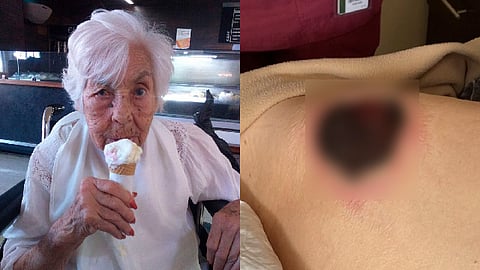 Ambas hermanas no revelaron más detalles al respecto, pero compartieron unas fotografías donde se ve a Doña Eva con una llaga de gran tamaño (Foto Twitter: Laura Zapata)