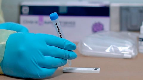 En Michoacán se estudiaron 110 mil 567 muestras, de las cuales 49 mil 426 se confirmaron como positivas (Foto Facebook:
Secretaría de Salud de Michoacán)