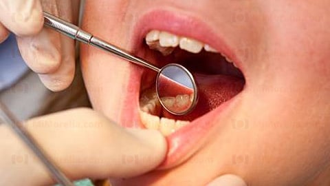 El Seguro Social cuenta con dos mil 284 estomatólogos, promotores y cirujanos maxilofaciales; el 9 de febrero se conmemora su día (Foto Archivo)