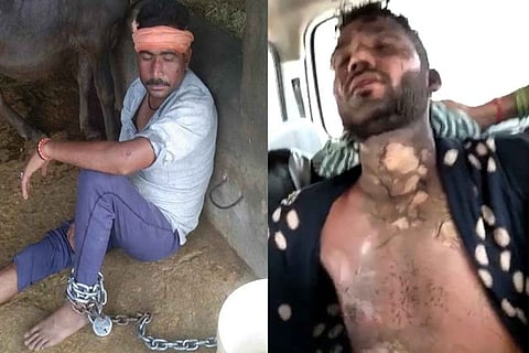 In UP, when a Dalit asked for wages, an attempt was made to set fire to him after dousing in petrol; in Rajasthan, a Dalit was made hostage by shackling his foot with a chain.