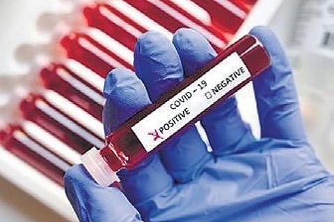 कोरोना रिपोर्टः लगातार बढ़ रहे हैं राज्यों में कोरोना के मामले