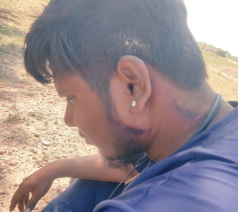 राजस्थान : बकरी चराने पर दलित पर जानलेवा हमला