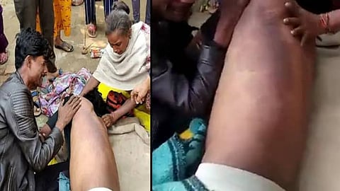 जितेन्द्र श्रीवास्तव के परिजनों ने पुलिस पर आरोप लगाया है कि उसकी मौत पीटने से हुई है।