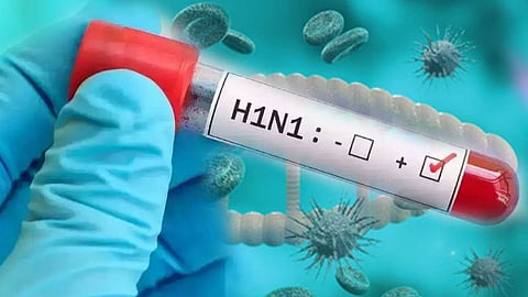 Agra on Swine Flu Alert 20 Bed Isolation Ward Prepared at District Hospital