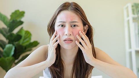 Festive skin care face par ye 5 cheezein na lagaye beauty tips rrs05