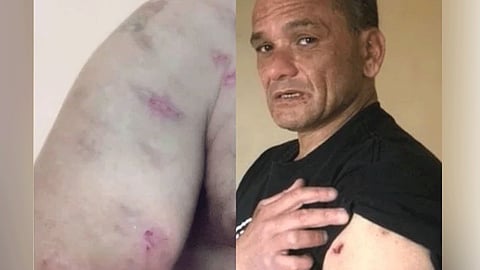 viral news hundreds-of-spiders-bite-and-injure-the-sleeping-person-forced-to-leave-the-house-and-live-in-a-tent