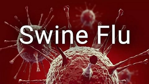 Swine Flu