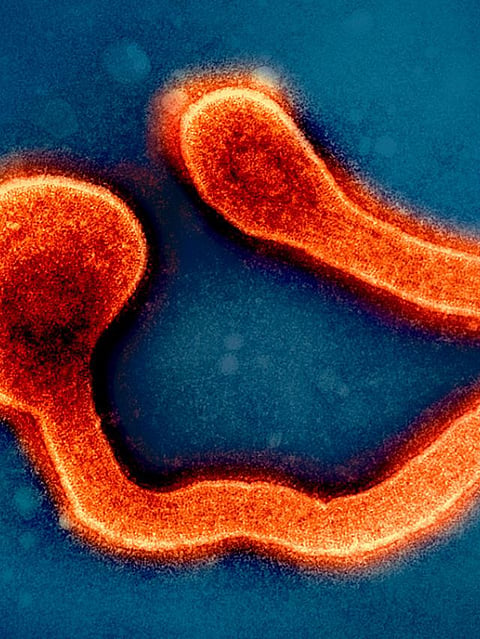 Marburg Virus (1)