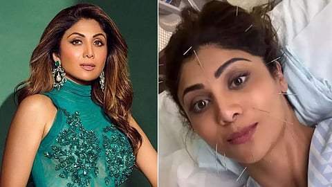 Shilpa Shetty Acupuncture Treatment Photo Went Viral