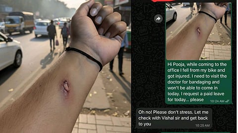 Employee fakes injury using AI to deceive HR and take medical leave, case goes viral.