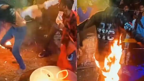 A boy set his pants on fire for a reel, got severely burned, and was heavily mocked online.