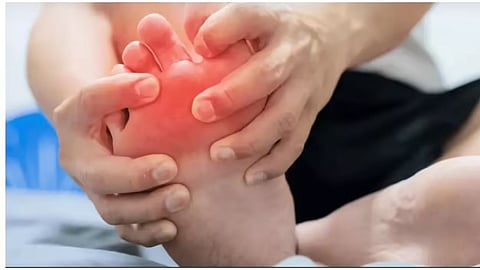 Uric Acid Control Tips