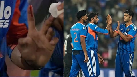 नागपुर में चोटिल हुआ भारत का स्टार ऑलराउंडर, अगले मैच खेलने पर सस्पेंस, हाथ से बहने लगा खून