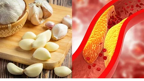 Garlic Health Benefits