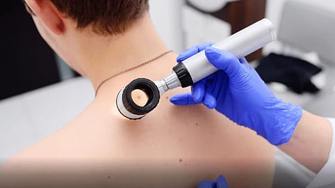 mumbai-skin-donation-shortage-burn-patient-treatment-crisis