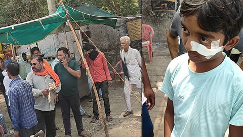 Suhagi Chai Mantralaya Tea Stall Attack On Child Also Attack Man Who Came To Intervened