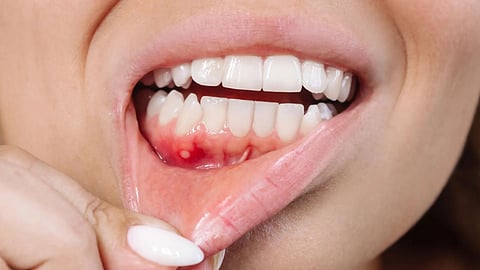 Warning Signs Of Gum Problems