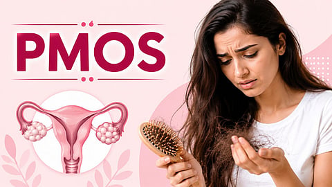 Hairfall Due to PMOS solution and regain of lost hair, expert opinion