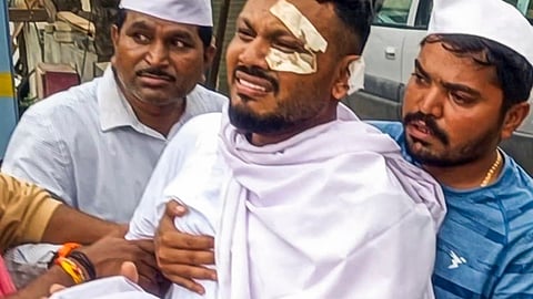 One year since the AI-171 plane crash: Vishwas was the sole survivor among 260 fatalities; now he is facing a major crisis.