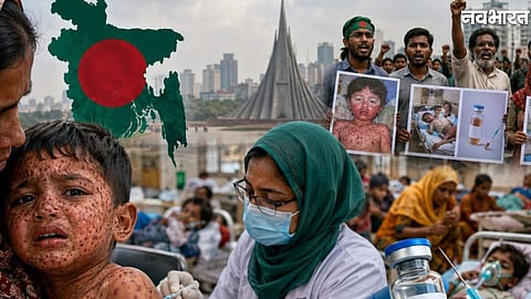 Measles Crisis: Fatal Outbreak Claims Over 600 Lives In Bangladesh Due To Vaccine Shortages