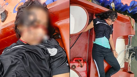 The body of a young woman was recovered from Lakha Banjara Lake in Sagar, triggering panic in the area and prompting a police investigation into the circumstances surrounding her death