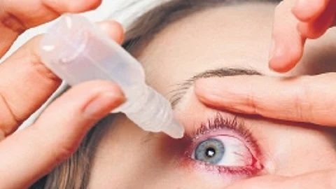 Dry eye, or keratoconjunctivitis sicca, is a common condition where the eyes either don’t produce enough tears or the tears don’t function properly.
