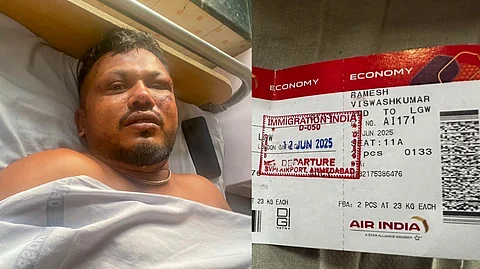 ViswashKumar Ramesh, the lone survivor of the Air India plane crash, receives treatment at a hospital in Ahmedabad.