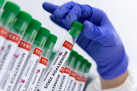 Kerala Confirms India's Second Monkeypox Case; 16 in Isolation