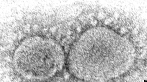 This 2020 electron microscope image made available by the Centers for Disease Control and Prevention shows SARS-CoV-2 virus particles which cause COVID-19.