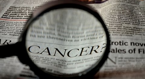 Detecting cancer biomarkers at an early stage. (IANS)