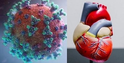 Patients who contract Covid-19 face a higher risk of developing cardiovascular diseases and diabetes. (IANS)