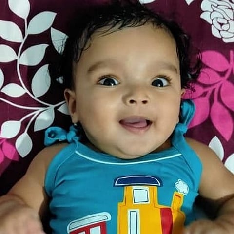A 23-month-old baby with Spinal Muscular Atrophy (SMA) Type 1. (IANS)