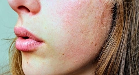 Ace Your Winter Glow. (IANS)