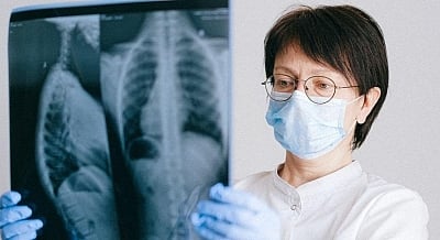 Pneumonia is a serious, potentially life-threatening lung infection that can strike both children and adults.