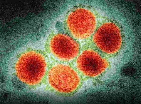 The China Centre for Disease Control and Prevention checked and tested the case specimens, and the result was positive for H3N8 avian influenza virus nucleic acid.