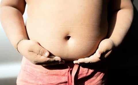 Childhood obesity in India likely to rise 9.1% annually by 2035. (IANS)