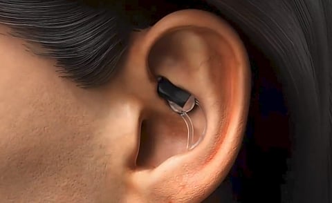 The in-ear wearable device by STAT Health can predict symptoms such as dizziness, brain fog, headaches, fainting, and fatigue that occur upon standing. (IANS)