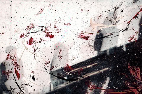 Abhay turned violent. Akash was first beaten up with a baton and then stabbed multiple times with a kitchen knife, causing him fatal injuries. (Representational image: Unsplash)