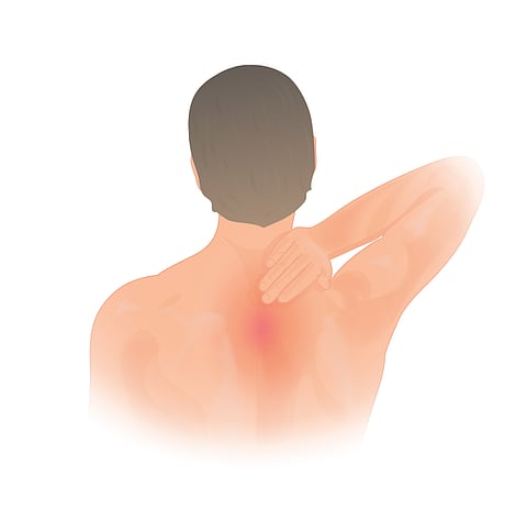 Opioid pain relievers have no benefit for people suffering from acute lower back and neck pain (Wikimedia Commons)