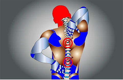 Chronic pain disorder linked to heightened risk of early death (Representative Image: Pixabay)