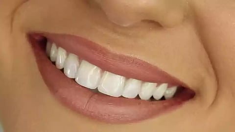 Take care of your teeth to boost brain health (Image: Wikimedia commons)