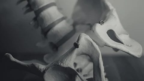 Hormonal changes, especially those during and after pregnancy, obesity, and unhealthy lifestyle are the major drivers of increasing instances of degenerative bone diseases in young women. (Unsplash)